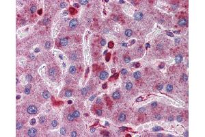 Immunohistochemistry (IHC) image for anti-Acid Phosphatase 2, Lysosomal (ACP2) (Middle Region) antibody (ABIN2782134) (ACP2 antibody  (Middle Region))