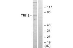 Western blot analysis of extracts from 293 cells, using TRI18 Antibody. (MID1 antibody  (AA 71-120))