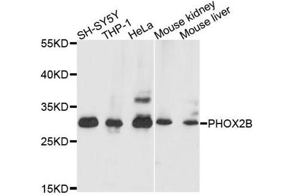 PHOX2B 抗体