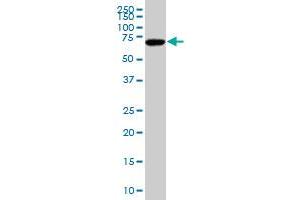 SOX9 polyclonal antibody (A01), Lot # 051017JC01 Western Blot analysis of SOX9 expression in Hela S3 NE . (SOX9 antibody  (AA 400-509))