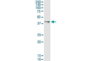 DGAT2 monoclonal antibody (M03), clone 4C1. (DGAT2 antibody  (AA 289-388))