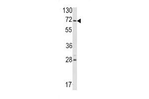 Western blot analysis of hUSP21- (ABIN388783 and ABIN2839115) in NCI- cell line lysates (35 μg/lane). (USP21 antibody  (AA 226-256))