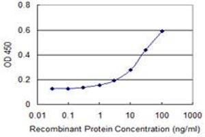 Image no. 1 for anti-serum/glucocorticoid Regulated Kinase Family, Member 3 (SGK3) (AA 1-130) antibody (ABIN599199) (SGK3 antibody  (AA 1-130))