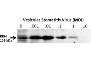 24-hour post infection immunoblots of whole cell lysates from primary murine microglia cells (2x106) untreated (0) or exposed to vesicular stomatitis virus at a range of viral particle/cell ratios. (DDX58 antibody  (C-Term))
