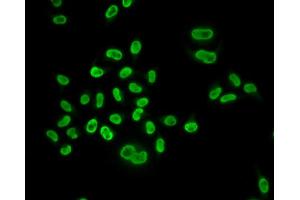 Immunofluorescence analysis of U2OS cells using MCM6 antibody. (MCM6 antibody)