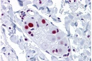 Human Small Intestine, submucosal plexus: Formalin-Fixed, Paraffin-Embedded (FFPE) (SNRPA1 antibody  (AA 1-283))