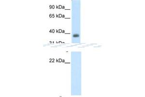 Western Blotting (WB) image for anti-Neurogenic Differentiation 2 (NEUROD2) antibody (ABIN2461776) (NEUROD2 antibody)