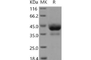Western Blotting (WB) image for Activin A Receptor, Type IB (ACVR1B) (Active) protein (Fc Tag) (ABIN7321211) (Activin A Receptor Type IB/ALK-4 Protein (Fc Tag))