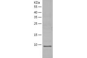 Western Blotting (WB) image for LSM2 Homolog, U6 Small Nuclear RNA Associated (LSM2) (AA 1-95) protein (His tag) (ABIN7289491) (LSM2 Protein (AA 1-95) (His tag))