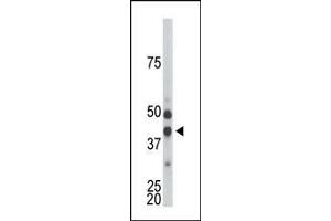 The anti-CDKL1 Pab is used in Western blot to detect CDKL1 in mouse kidney tissue lysate. (CDKL1 antibody  (C-Term))