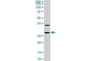CITED1 monoclonal antibody (M04), clone 6E12. (CITED1 antibody  (AA 94-193))