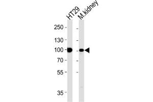 Western Blotting (WB) image for anti-Villin 1 (VIL1) antibody (ABIN5022700) (Villin 1 antibody)