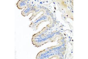 Immunohistochemistry of paraffin-embedded human trachea using IL10 antibody at dilution of 1:100 (x40 lens). (IL-10 antibody)