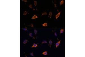 Immunofluorescence analysis of L929 cells using SEMA antibody (ABIN7270199) at dilution of 1:100. (Sema4a antibody  (AA 320-580))