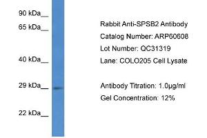 Western Blotting (WB) image for anti-SplA/ryanodine Receptor Domain and SOCS Box Containing 2 (SPSB2) (C-Term) antibody (ABIN2788511) (SPSB2 antibody  (C-Term))