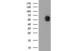 HEK293T cells were transfected with the pCMV6-ENTRY control (Left lane) or pCMV6-ENTRY EXD1 (Right lane) cDNA for 48 hrs and lysed. (EXD1 antibody)