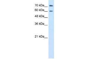 WB Suggested Anti-PRODH2 Antibody Titration:  0.