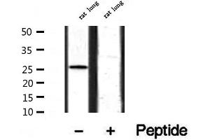 Western blot analysis of extracts from rat lung, using BCA3 Antibody. (AKIP1 antibody  (Internal Region))