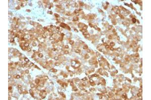 Image no. 1 for anti-Tyrosinase (TYR) antibody (ABIN6189763) (TYR antibody)
