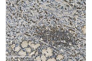 IHC analysis of PARP using anti-PARP antibody (ABIN7602278). (PARP1 antibody  (AA 670-858))