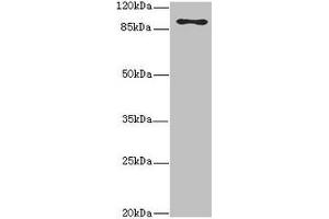 Western blot All lanes: MTHFD1L antibody at 3. (MTHFD1L antibody  (AA 759-978))