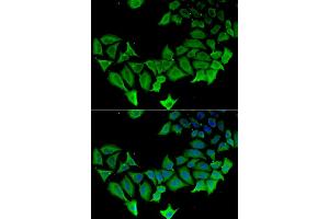 Immunofluorescence analysis of HeLa cells using APLP1 antibody (ABIN5975741). (APLP1 antibody)