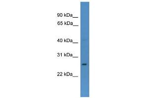 Western Blotting (WB) image for anti-Caudal Type Homeobox 1 (CDX1) (N-Term) antibody (ABIN2780382)
