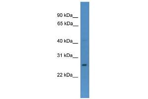 WB Suggested Anti-CDX1 Antibody Titration:  0. (CDX1 antibody  (N-Term))