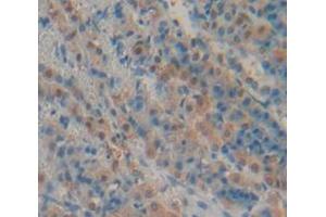Figure. (FABP6 antibody  (AA 1-128))