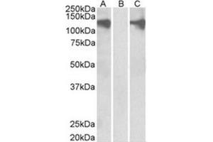 Image no. 1 for anti-Pumilio Homolog 2 (Drosophila) (PUM2) (Internal Region) antibody (ABIN374533) (PUM2 antibody  (Internal Region))
