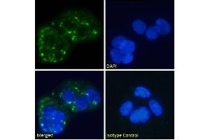 Immunofluorescence staining of fixed HepG2 cells with anti-Human Glucagon Receptor antibody hGR-2 F6. (Recombinant Glucagon Receptor antibody)