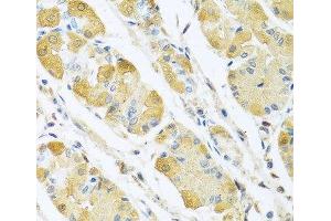 Immunohistochemistry of paraffin-embedded Human stomach using C4BPB Polyclonal Antibody at dilution of 1:100 (40x lens). (C4BPB antibody)