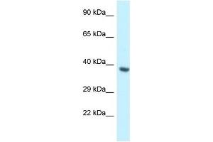Western Blot showing BCL2L12 antibody used at a concentration of 1 ug/ml against Fetal Heart Lysate (BCL2L12 antibody  (Middle Region))