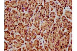 IHC image of ABIN7161327 diluted at 1:300 and staining in paraffin-embedded human pancreatic cancer performed on a Leica BondTM system. (NLN antibody  (AA 109-241))
