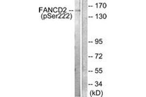 Western blot analysis of extracts from HT29 cells treated with Calyculin A 50ng/ml 30', using FANCD2 (Phospho-Ser222) Antibody. (FANCD2 antibody  (pSer222))