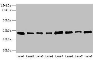 Western blot All lanes: PLP1 antibody at 4 μg/mL Lane 1: Hela whole cell lysate Lane 2: HL60 whole cell lysate Lane 3: K562 whole cell lysate Lane 4: THP-1 whole cell lysate Lane 5: U937 whole cell lysate Lane 6: A549 whole cell lysate Lane 7: Caco-2 whole cell lysate Lane 8: HepG2 whole cell lysate Secondary Goat polyclonal to rabbit IgG at 1/10000 dilution Predicted band size: 31, 27 kDa Observed band size: 31 kDa (PLP1 antibody  (AA 143-197))