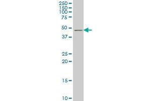 TSC22D4 monoclonal antibody (M07), clone 4G7 Western Blot analysis of TSC22D4 expression in Hela S3 NE . (TSC22D4 antibody  (AA 1-395))