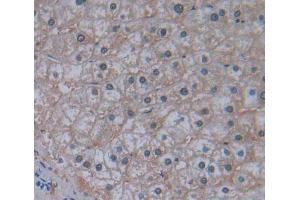 Immunohistochemistry (IHC) image for anti-Mars (MARS) (AA 74-198) antibody (ABIN5013932)
