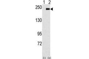 Western Blotting (WB) image for anti-Sperm Associated Antigen 9 (SPAG9) antibody (ABIN3003116)