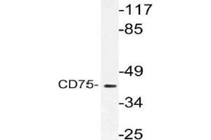 Western blot (WB) analysis of CD75 antibody in extracts from RAW264. (ST6GAL1 antibody)