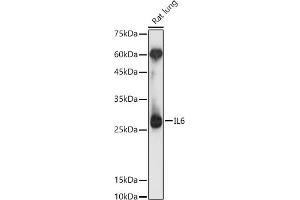 Western blot analysis of extracts of Rat lung, using IL6 antibody (ABIN1513075, ABIN1514222, ABIN1683697 and ABIN6213773) at 1:1000 dilution. (IL-6 antibody  (AA 30-212))