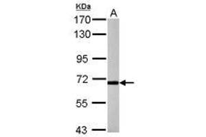 Image no. 1 for anti-Purinergic Receptor P2X, Ligand-Gated Ion Channel, 7 (P2RX7) (C-Term) antibody (ABIN1495909) (P2RX7 antibody  (C-Term))