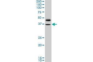 PAX8 monoclonal antibody (M10), clone 3G11. (PAX8 antibody  (AA 300-377))