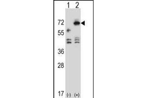 Western blot analysis of ARSF (arrow) using rabbit polyclonal ARSF Antibody (Center) (ABIN657171 and ABIN2846304). (ARSF antibody  (AA 236-264))