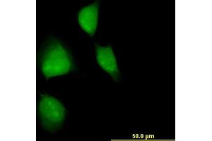 Immunofluorescence of monoclonal antibody to MAPKAPK2 on HeLa cell. (MAPKAP Kinase 2 antibody  (AA 266-352))