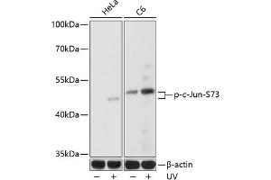 Western blot analysis of extracts of various cell lines, using Phospho-c-Jun-S73 antibody (ABIN3023567, ABIN3023568, ABIN3023569 and ABIN6225411) at 1:1000 dilution. (C-JUN antibody  (pSer73))