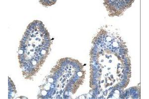 Image no. 1 for anti-Ubiquitin-Conjugating Enzyme E2, J2 (UBE2J2) (C-Term) antibody (ABIN203529) (UBE2J2 antibody  (C-Term))