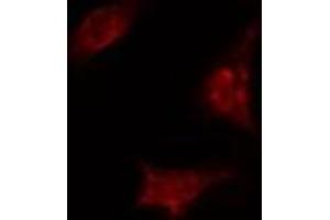 ABIN6274367 staining A549 cells by IF/ICC. (TAF5 antibody  (Internal Region))