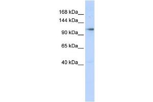WB Suggested Anti-ZMIZ1 Antibody Titration:  0. (ZMIZ1 antibody  (N-Term))