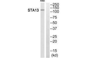 Western blot analysis of extracts from K562 cells, using STA13 antibody.